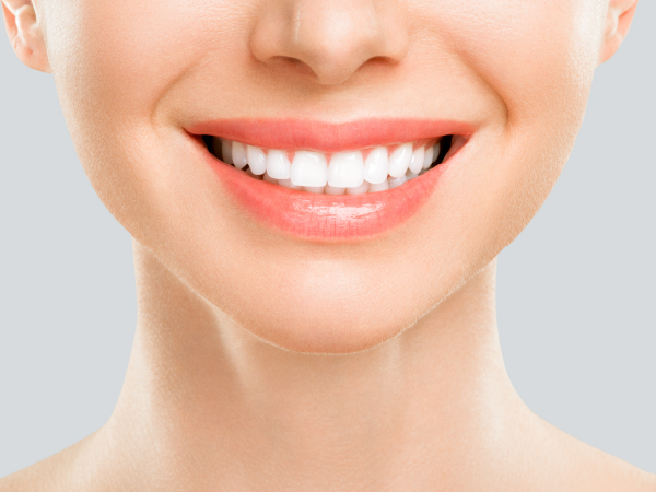 ホワイトニング